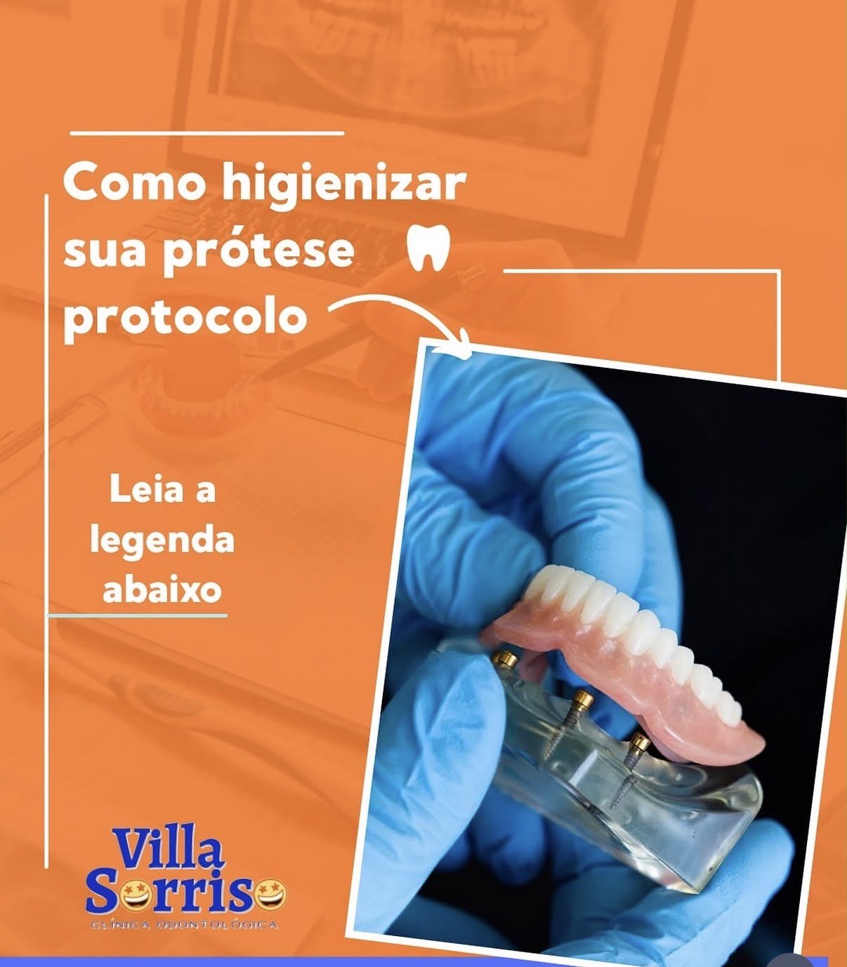 Conteúdo educativo da Villa Sorriso sobre prótese protocolo