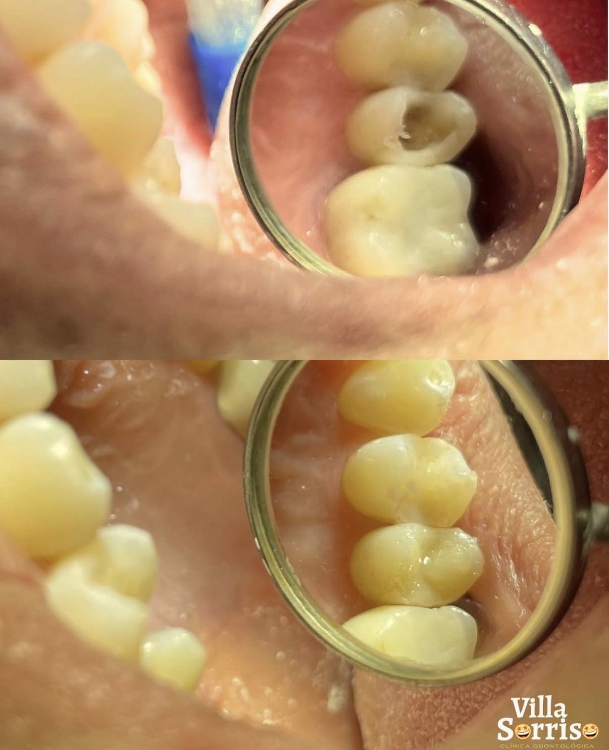 Odontologia restauradora